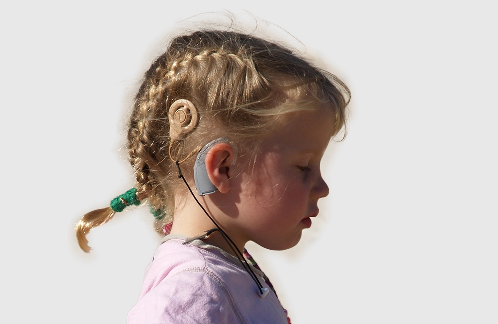 Cochlear Implant Rehabilitation